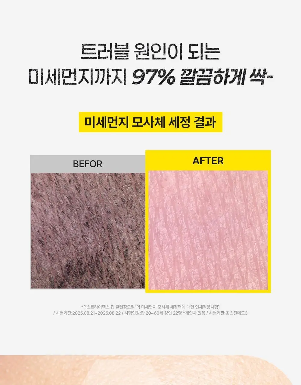 [놓치면끝] 스트라이덱스 포어 리셋 딥 클렌징오일 200ml 상세페이지 21